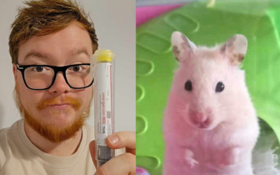 Man Nearly Dies After Hamster Bite Triggers Rare Allergic Reaction • Hollywood Unlocked