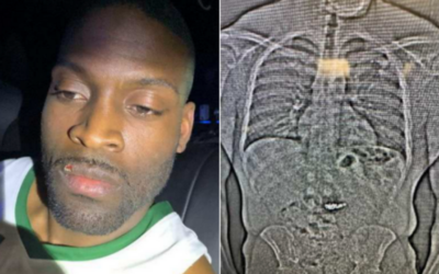 Florida Man Swallows Tiffany Jewelry After $796K Heist, Caught by Police