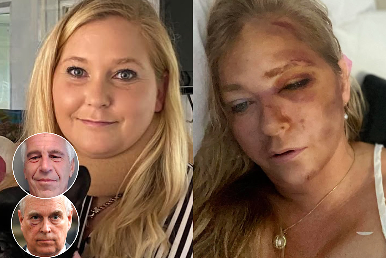 Jeffrey Epstein And Prince Andrew Accuser Virginia Giuffre Given ‘4 Days To Live’ After Being Hit By School Bus: ‘I’m Ready To Go’
