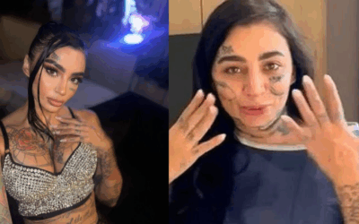 Brazilian Influencer Dies After Plastic Surgery in Turkey, Husband Says She Went Into Cardiac Arrest Following Multiple Procedures