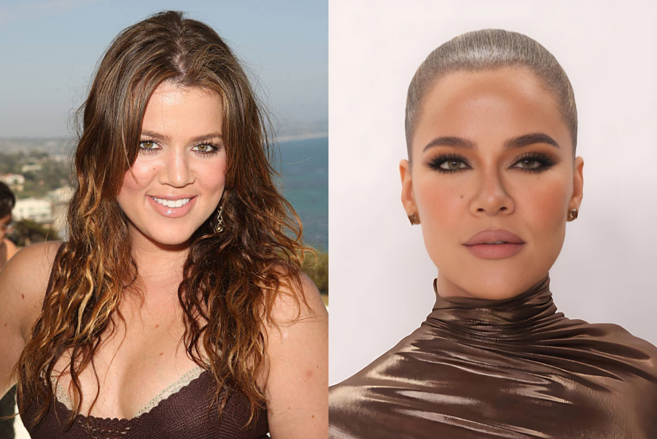 Khloe Kardashian Reveals Her Cosmetic Procedures • Hollywood Unlocked