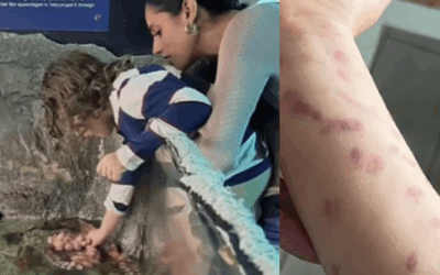 6-Year-Old Boy Attacked by Octopus at San Antonio Aquarium