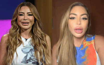 Larsa Pippen Addresses 'Haters' And Concerns About 'Swollen' Face: 'I Had An Allergic Reaction To PRP, I Feel Like Someone Made My Photo Look Like That